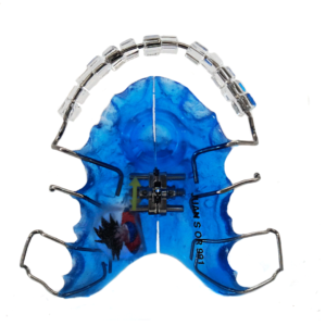 Placas Castillo Morales