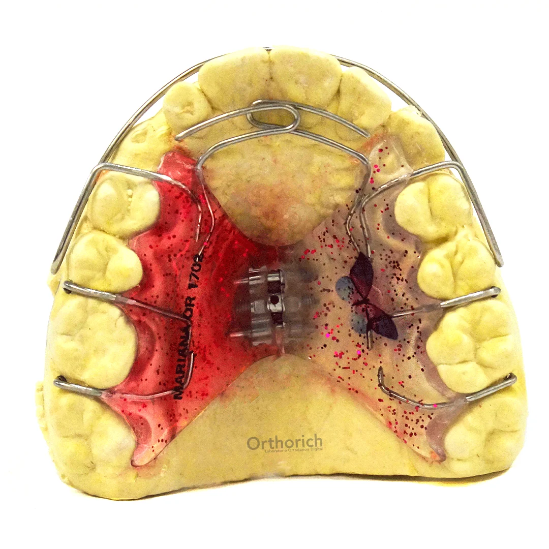 Placa de expansión -orthorich