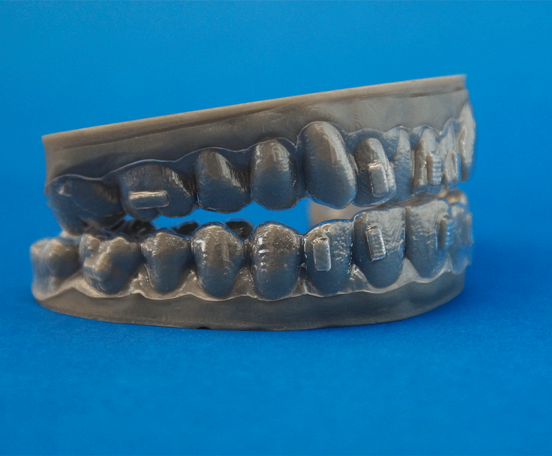 Alineadores 3D Orthorich