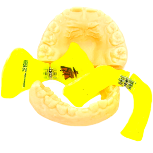 Disyuntor de McNamara