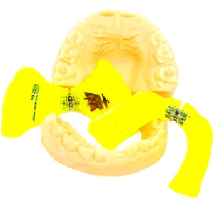 Disyuntor de McNamara